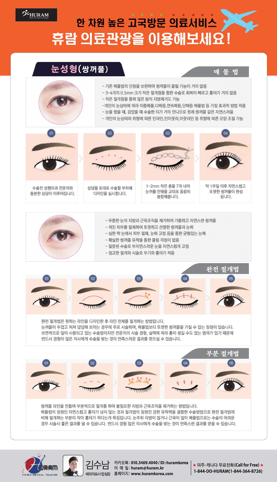 눈성형 – Huram Korea, image size:950x1653