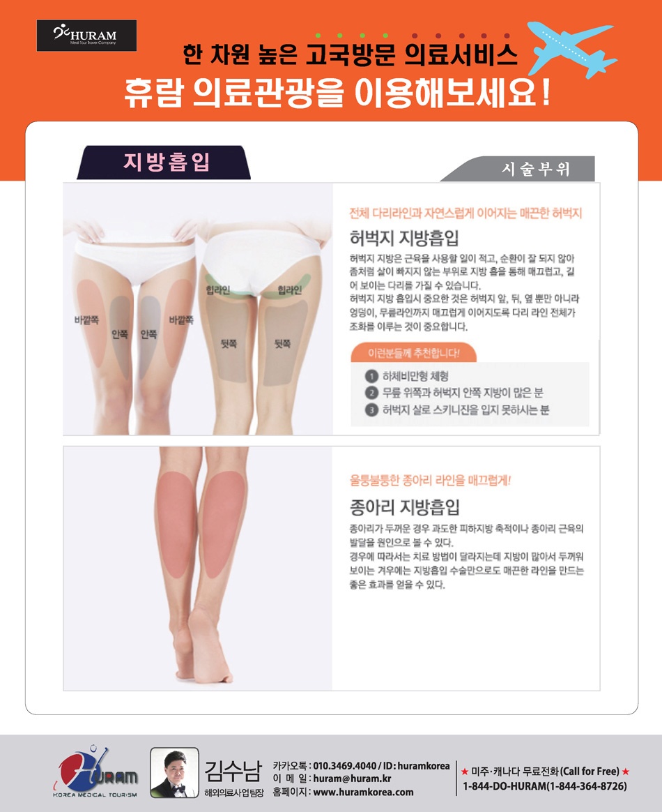 체형성형_지방흡입(허벅지,종아리)